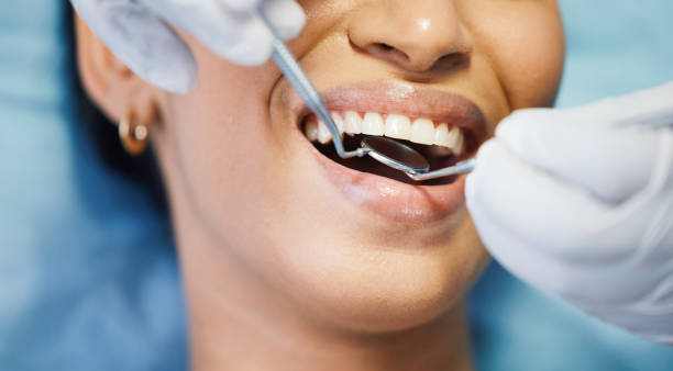 Best Dentist for Tooth Abscess  in Patterson Tract, CA