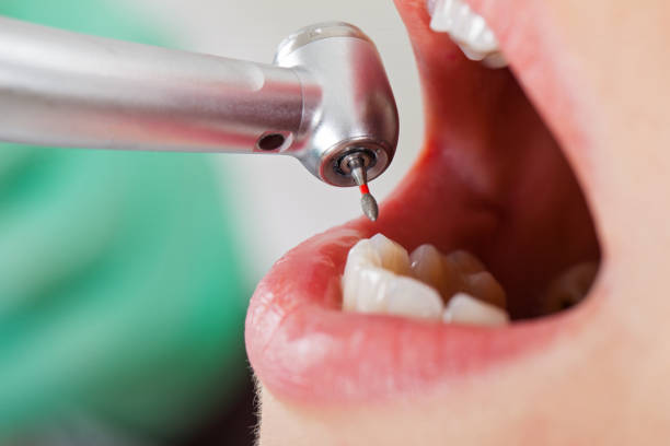 Best Affordable Emergency Dental Care  in Patterson Tract, CA